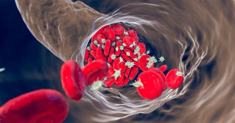 Infografika: Příčiny a mechanismus vzniku křečových žil