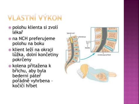 Infografika znázorňující polohu pacienta během lumbální punkce a anatomii bederní páteře
