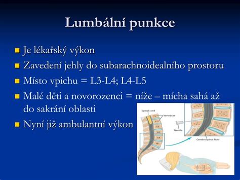 Schéma správného umístění vpichu při lumbální punkci a orientace vpichu