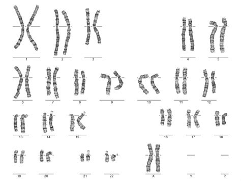 schéma chromozomální aberace