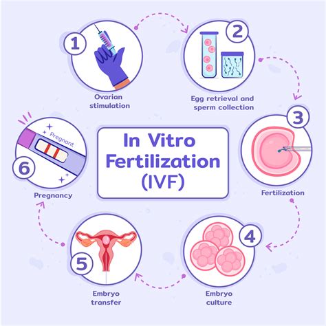 Infografika: Cesta IVF na ISCARE - od vstupní konzultace po embryotransfer
