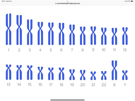 Schéma zobrazující odběr krve matky pro NIPT a analýzu volné fetální DNA