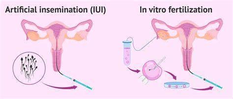 Infografika: Schéma procesu IVF a IUI s darovaným spermem