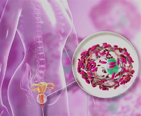 Infografika: Jak vzniká bakteriální vaginóza a její dopady na plodnost