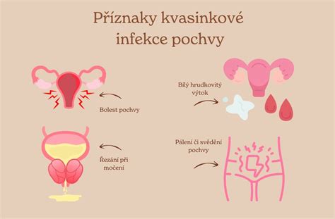 Infografika porovnávající příznaky a léčbu kvasinkové a bakteriální vaginální infekce