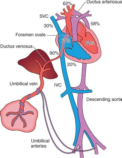 cévní zkratky fetálního oběhu: ductus venosus, foramen ovale, ductus arteriosus