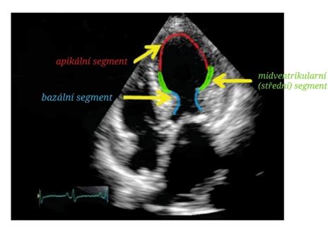 veterinář provádějící ultrazvukové vyšetření srdce kočky
