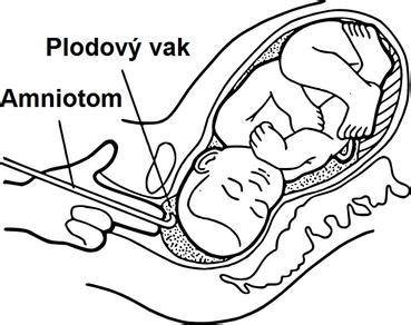 Infografika: Jak vypadá plodová voda, její objemy a barvy