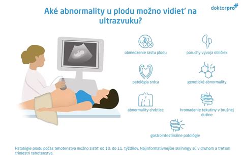 Infografika: princip ultrazvuku a hledání tepu plodu, umístění snímače na břiše, zobrazení signálu na displeji