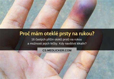 Infografika: Celkový přehled příčin a léčby popraskané kůže na rukou