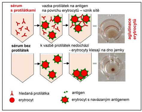 schematické znázornění anafylaktické reakce v těhotenství
