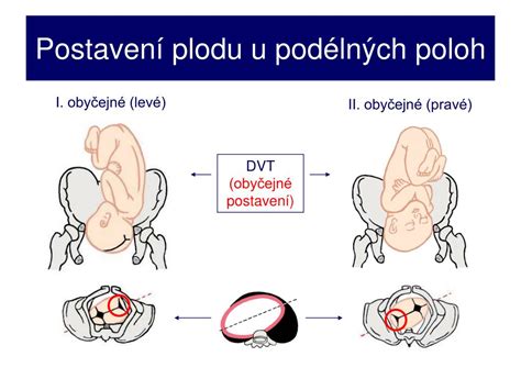 Infografika mechanismu porodu: postupná rotace hlavičky a průchod plodu pánví