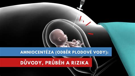 Infografika: Průběh těhotenství a význam plodové vody
