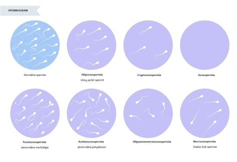 infografika srovnávající tradiční spermiogram s pokročilými metodami diagnostiky DNA spermií