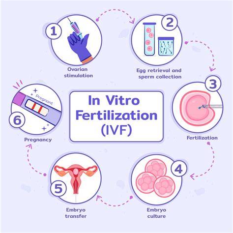 Infografika: Přehled IVF procesu (přehled kroků od stimulace po transfer)
