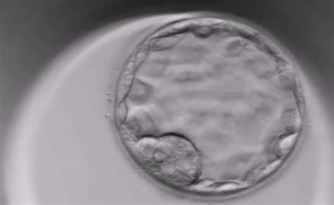 Infografika: Jak probíhá embryotransfer a vývoj embrya po IVF