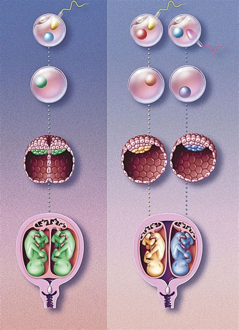 Schéma vzniku jednovaječných a dvojvaječných dvojčat