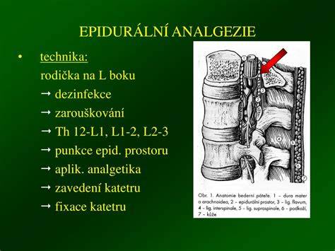 Infografika: Epidurální analgezie a alternativní metody tlumení bolesti během porodu