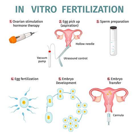 schéma zobrazující proces IVF od stimulace po transfer embrya