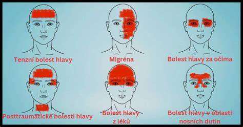 mapa typů suché pokožky hlavy a tipy pro péči