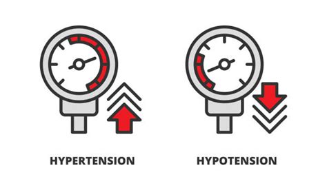 Schéma svalového napětí (hypotonie vs. hypertonie)