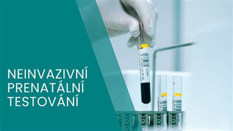 Infografika: Jak probíhá neinvazivní prenatální test otcovství