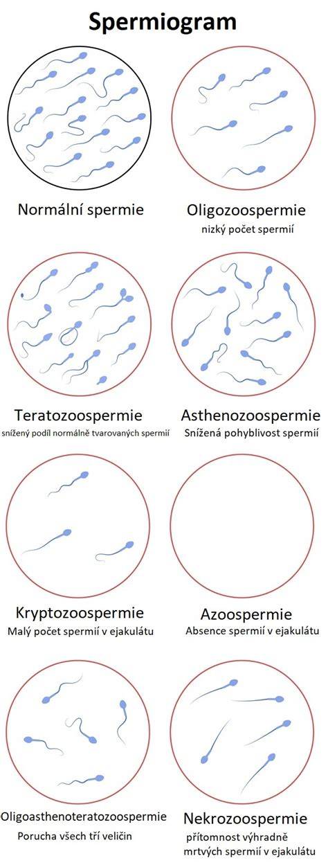 Infografika: Postup darování spermií a klíčová vyšetření