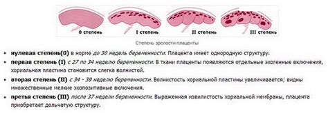 Tabulka: Srovnání rizik prodlouženého těhotenství a předčasného zrání placenty