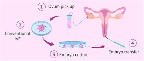 1000x600_informativni_schema_ivf.jpg