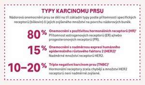 Infografika: Typy nezhoubných nádorů prsu a jejich charakteristiky
