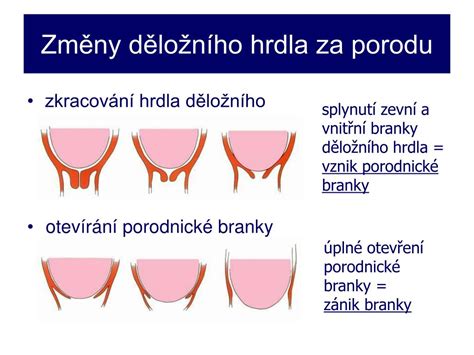 Schematické znázornění děložního hrdla během porodu