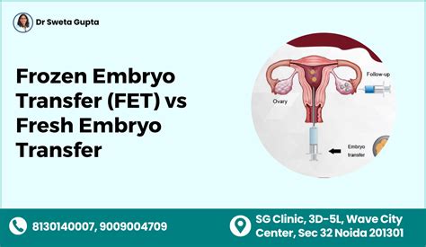 Infografika ukazující čerstvý transfer vs. kryoembryotransfer (KET) a jejich přípravu