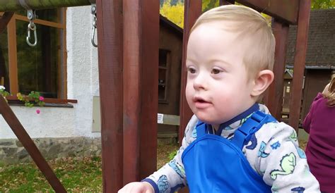 Koláž fotografií dětí a dospělých s Downovým syndromem ukazující typické fyzické rysy.
