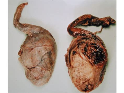 Schéma anatomie mužského reprodukčního ústrojí a cest spermií