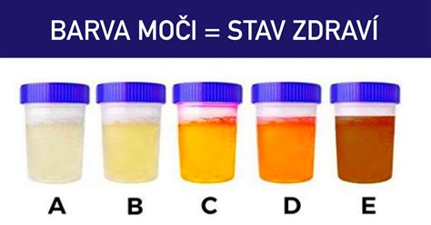 Ranní moč jako ideální vzorek pro těhotenský test