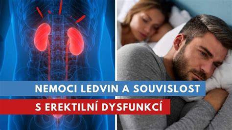 Infografika: Základní mechanismus účinku léků na erektilní dysfunkci