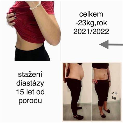 Infografika: Poporodní pásy a jejich možnosti (zachycení rozpuštění břicha, diastáza, jizva)