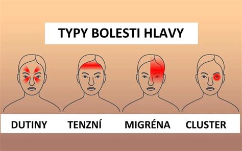 Ilustrace znázorňující pulzující bolest hlavy typickou pro migrénu