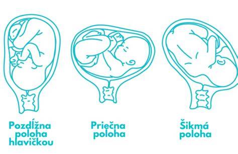 Infografika: Diagnostika poloha plodu a významy rozhodnutí v léčebném procesu