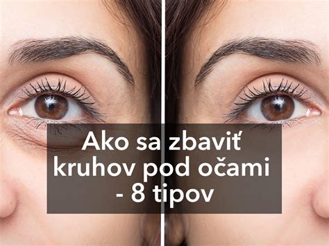 schéma zobrazující různé příčiny kruhů pod očima u dětí