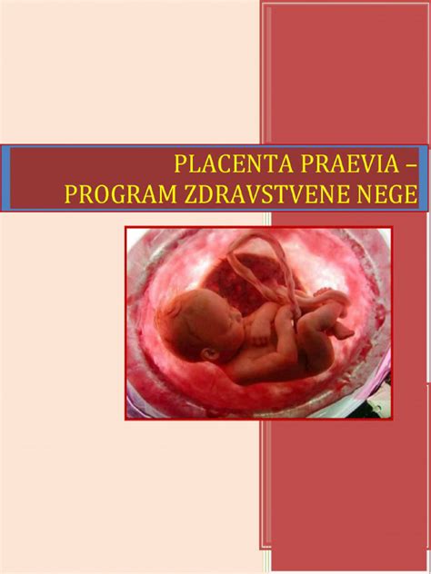 Ultrazvukový snímek znázorňující nízko položenou placentu (placenta praevia).