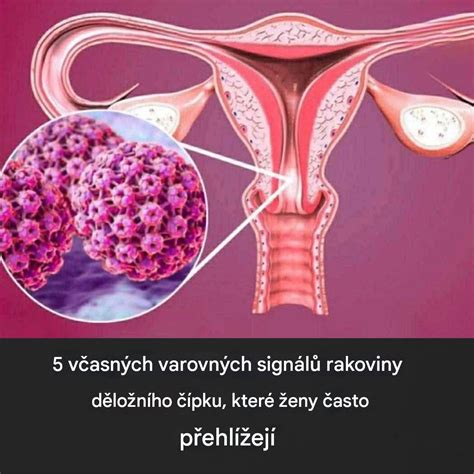 ilustrace raných těhotenských příznaků