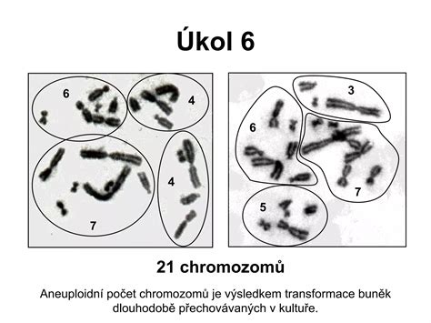 Ilustrace chromozomů, znázorňující trizomii 21.