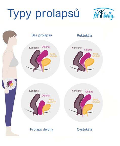 Infografika: Anatomie poševní stěny a pánevního dna po porodu
