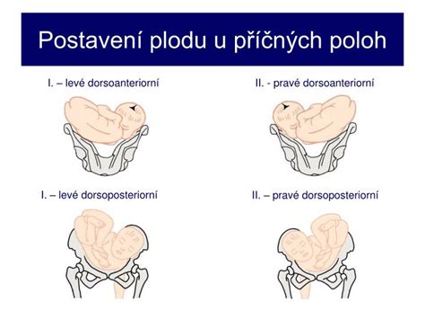 znázornění různých předních a zadních postavení plodu v podélné poloze