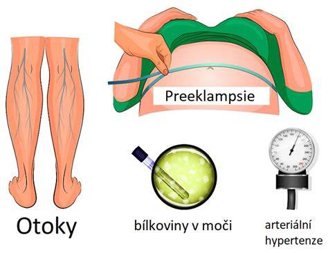 Infografika: proteinurie a preeklampsie - co sledovat v těhotenství