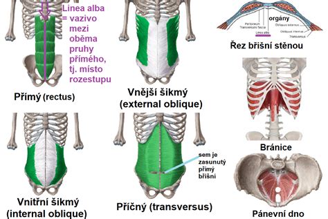 Detailní anatomické schéma břišní stěny s vyznačením pupíku a možných míst vzniku kýly.
