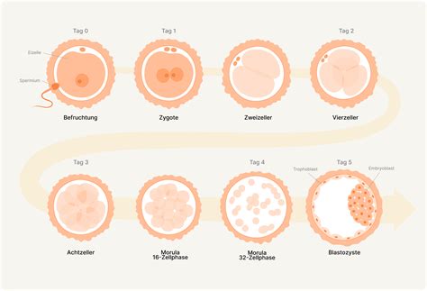 Infografika procesu IVF: od vstupní konzultace po embryotransfer