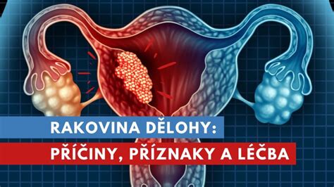 ilustrace změn dělohy během šestinedělí