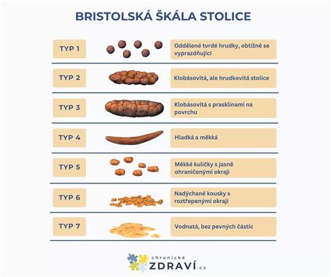 ukázka různého vzhledu stolice kojenců